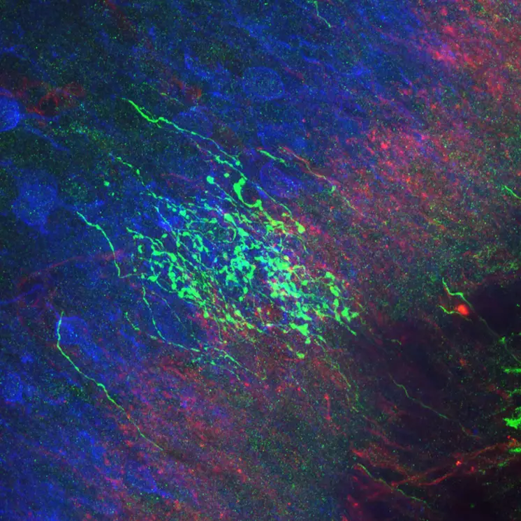 Picture highlighting a dense ramification of a single C-LTMR within lamina II inner of dorsal horn spinal cord